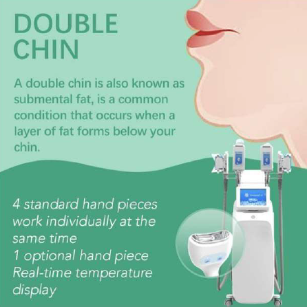 Cryolipolysis - Fat Freezing Machine