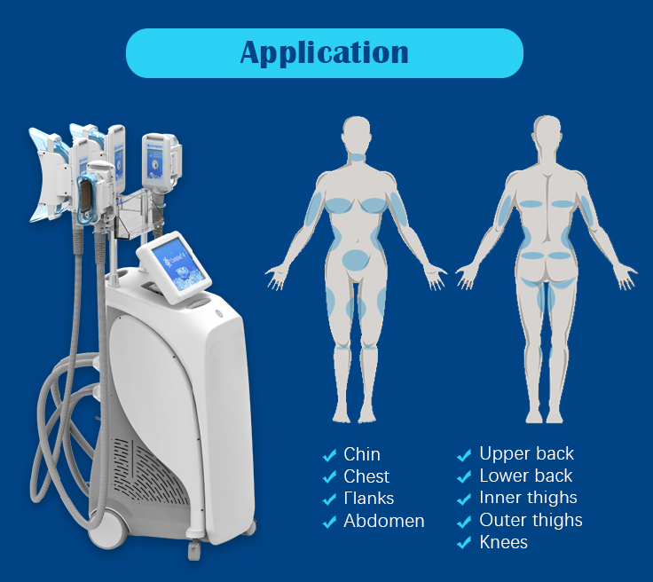 Cryolipolysis - Fat Freezing Machine